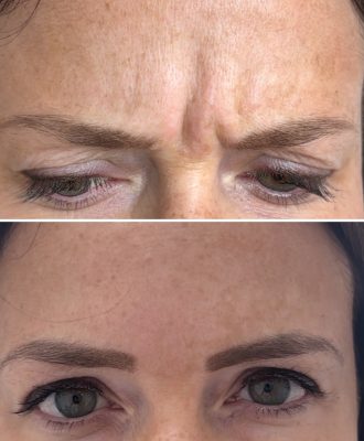 cejas
